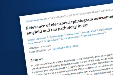Relevance of electroencephalogram assessment in amyloid and tau pathology in rat